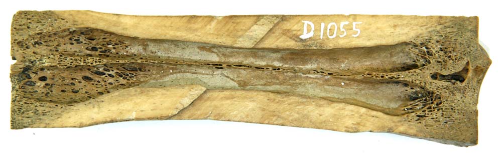 Mellemfodsknogle fra okse. Gennemskåret på langs, og den ene ledende er afsavet. Desuden findes spor af grovere tilglatning på begge ledhoveders sidekanter. Indsavning sket fra begge ender, i midten brudflader. Længde: 14,2 cm.