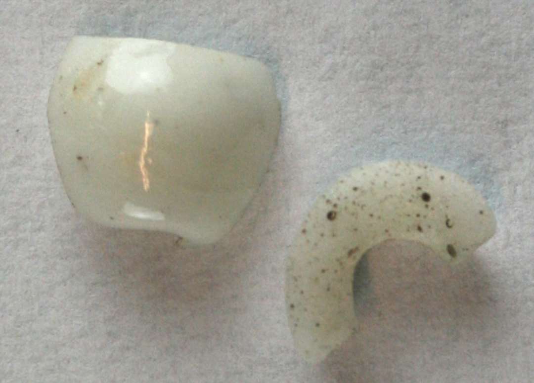 ½ (a) og to mindre fragmenter (b) af kugleformede til svagt dobbeltkonisk perler af ugennemsigtig hvidlig glasmasse. 8-9 mm.